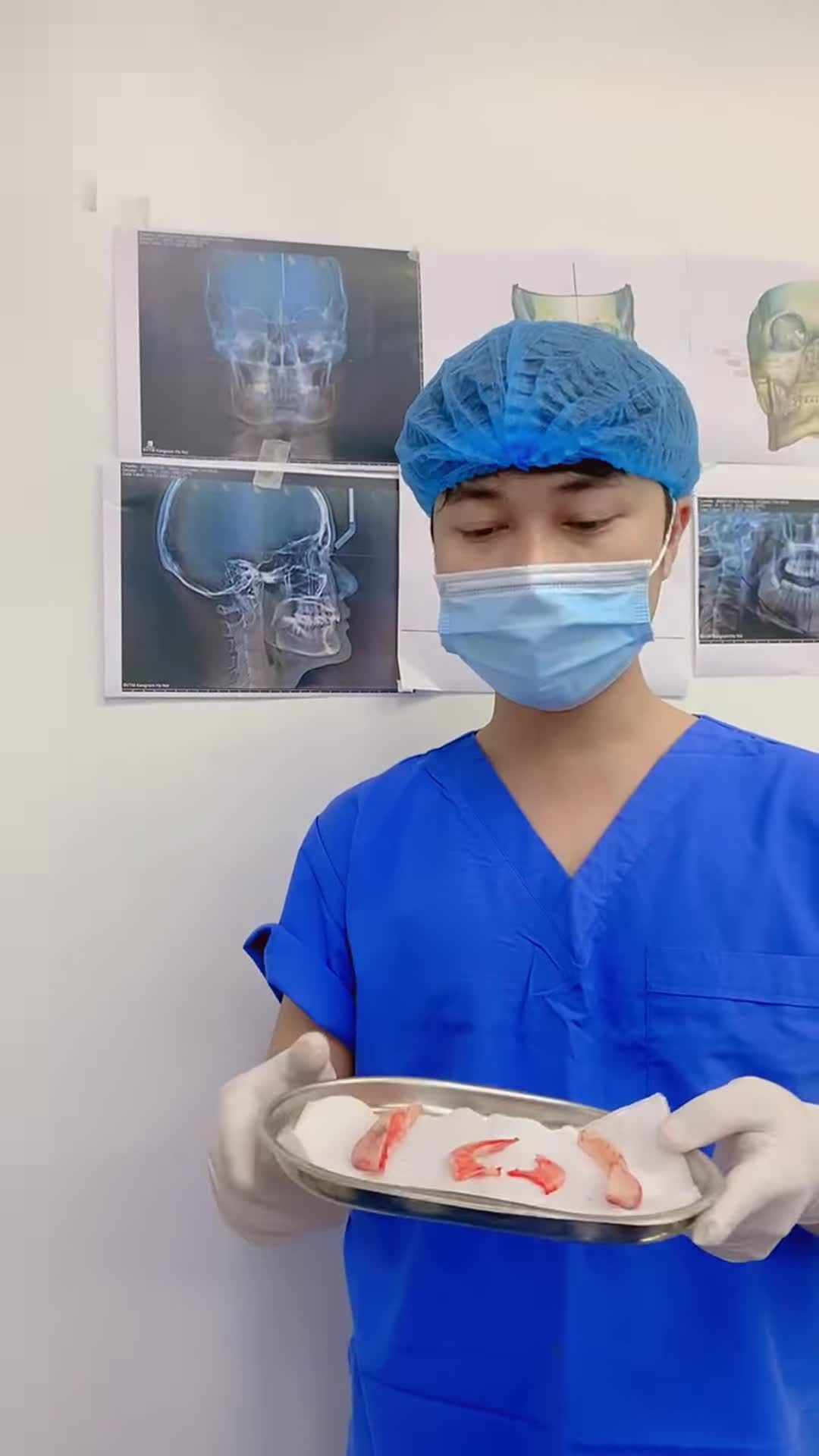 Giật mình nhẹ với kết quả của khách hàng sau khi làm dịch vụ gọt hàm, hạ gò má